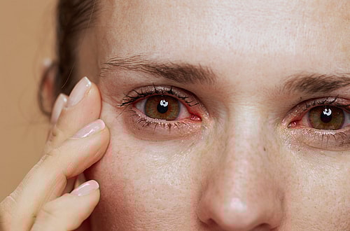 Allergic To Your Dog