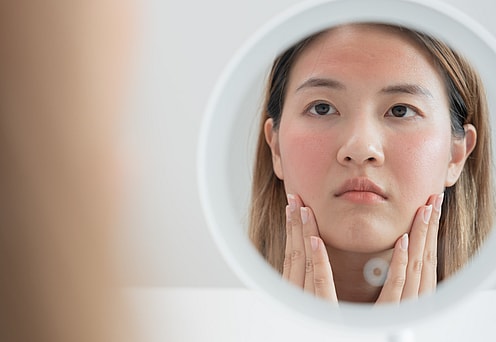 Allergic To Your Dog